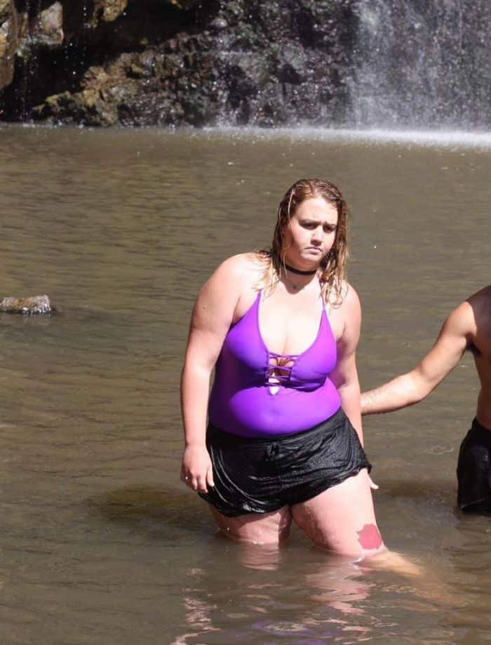 מאי בוצצו לפני הניתוח