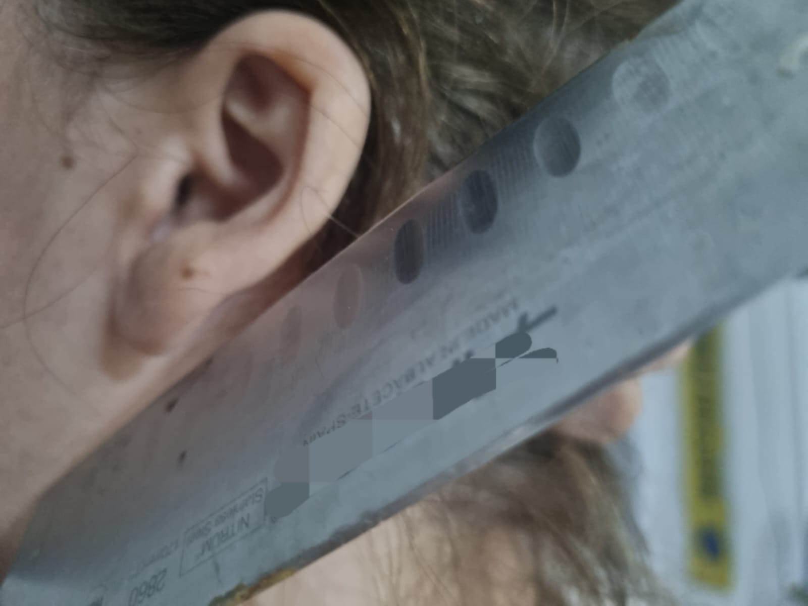 ראשון לציון: נשך את אוזן שכנו ותלש אותה