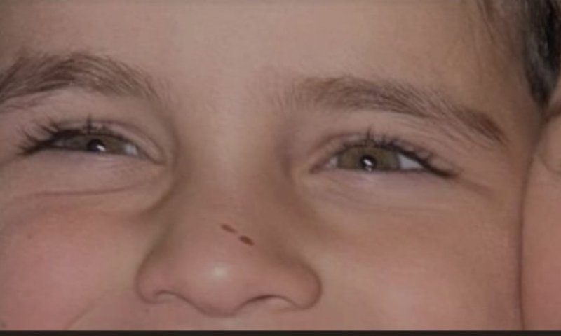 ילד מראשון לציון נלחם על הזכות לראות: סיפורו של ריאן בן ה־5