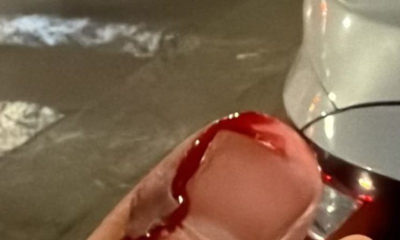 כתב אישום יוגש נגד תושב חולון שתקף ופצע שוטרים  