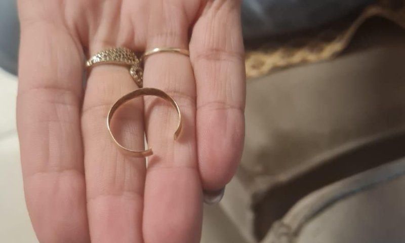 מתנדב ידידים הוזעק לעזרת אישה בחולון שטבעת נתקעה על אצבעה