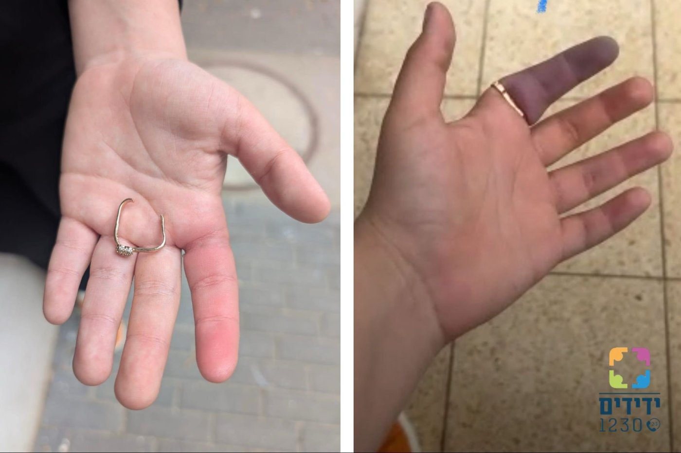 טבעת נתקעה על אצבע אישה בחולון