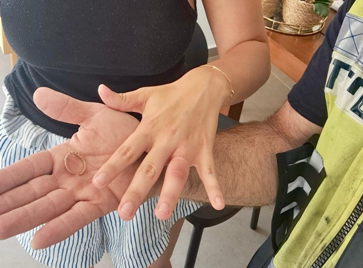צעירה מראשון לציון נזקקה לעזרה בחילוץ טבעת מהאצבע