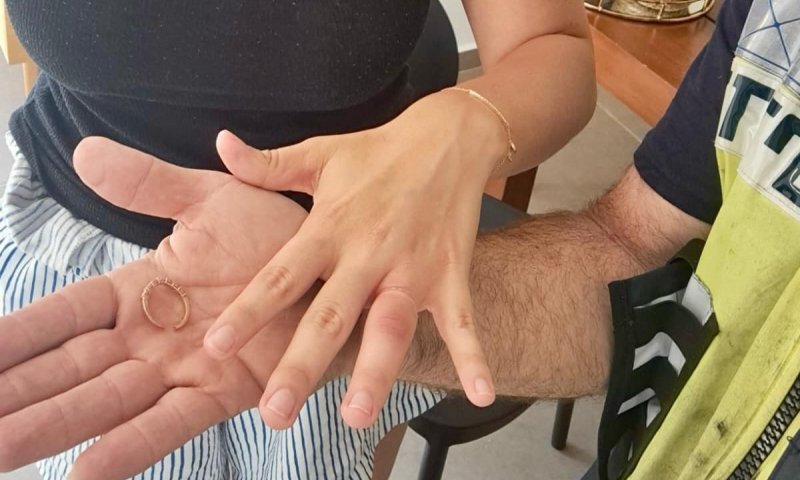 צעירה מראשון לציון נזקקה לעזרה בחילוץ טבעת מהאצבע