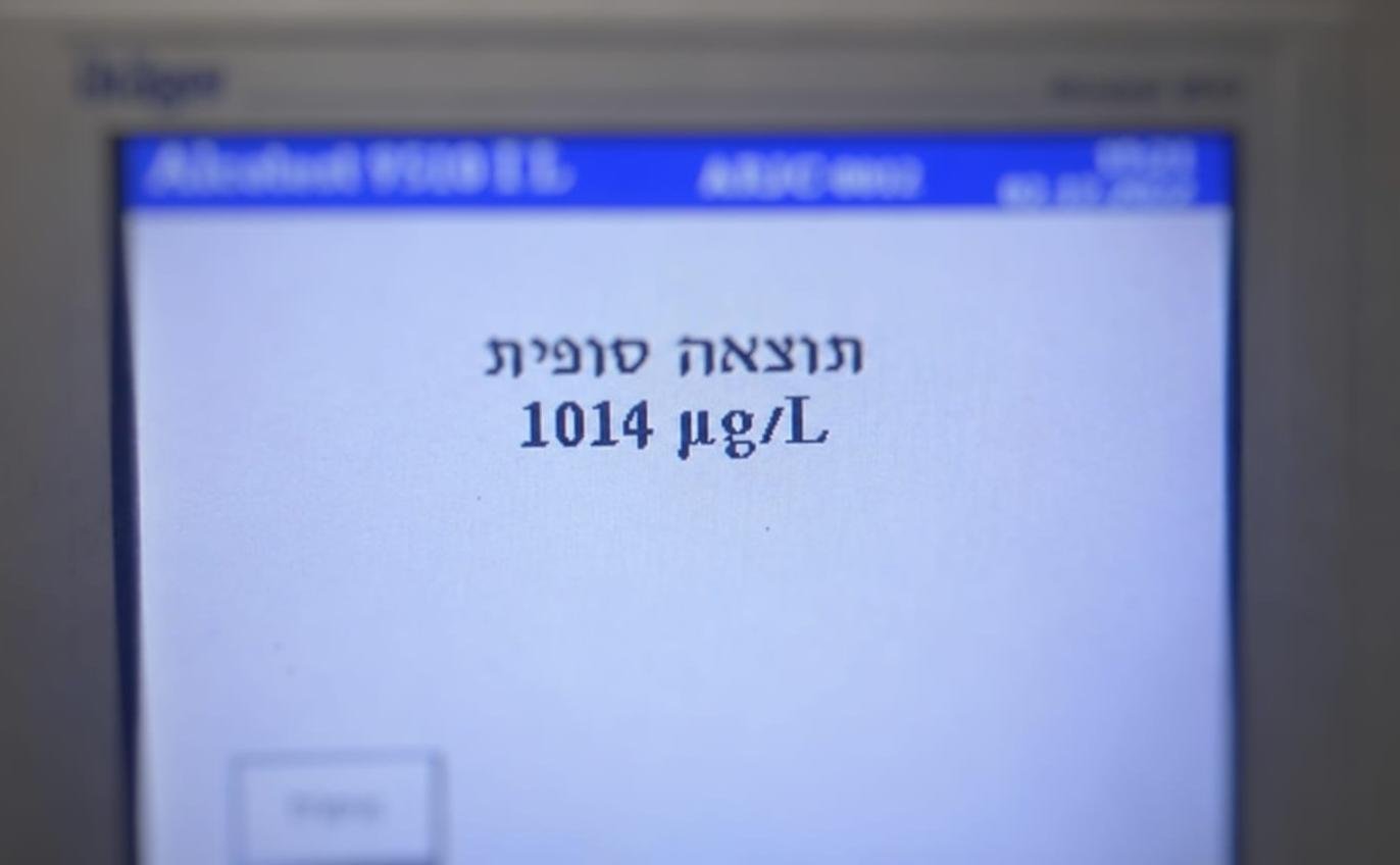 רוכב אופניים נתפס בבת ים עם כמות אלכוהול חריגה בגופו